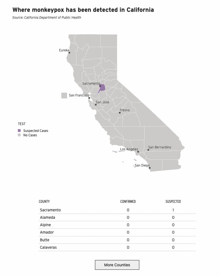 Suspected monkeypox case in California What you should know Piedmont